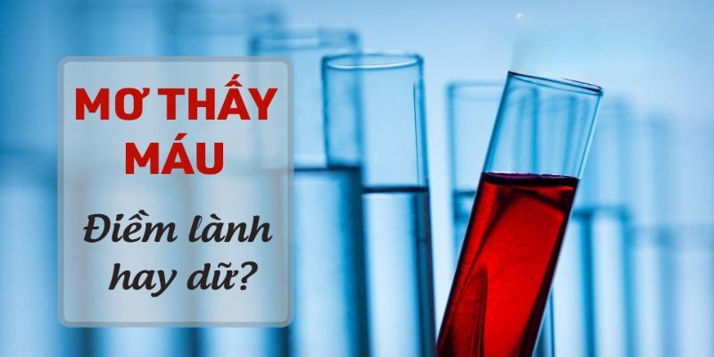 Chiêm bao thấy máu thì điềm tốt hay xấu?